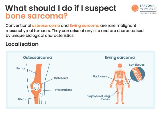 Sarcoma CONNECT Bone Sarcoma Flashcard